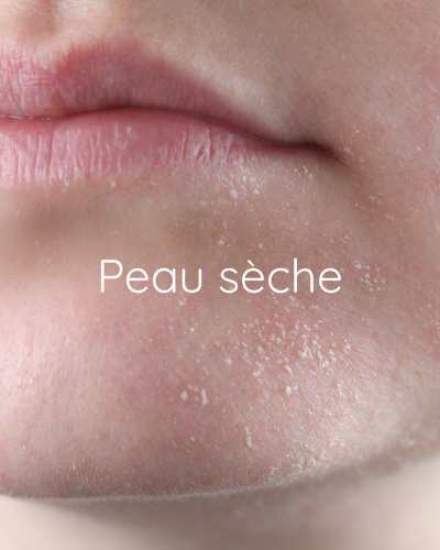 bois ta skincare peau sèche